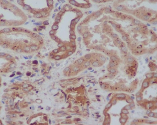 Anti-Tyrosine Hydroxylase Rabbit Polyclonal Antibody