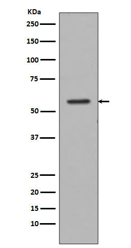 Anti-Tyrosine Hydroxylase Rabbit Polyclonal Antibody