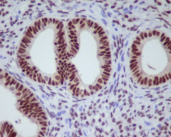 Anti-Progesterone Receptor Rabbit Polyclonal Antibody