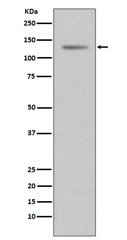 Anti-Progesterone Receptor Rabbit Polyclonal Antibody
