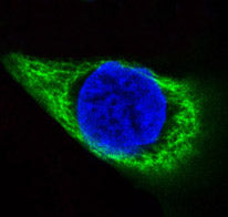 Anti-Cytokeratin 14 Rabbit Polyclonal Antibody