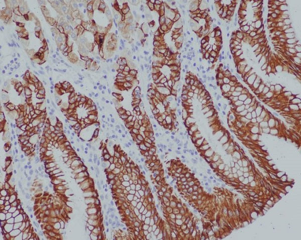 Anti-Cytokeratin 14 Rabbit Polyclonal Antibody