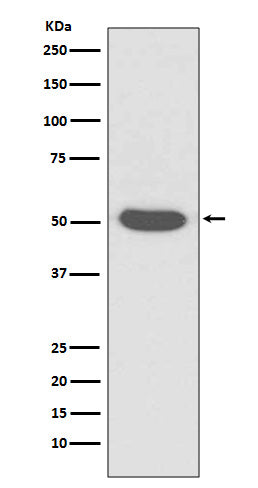 Anti-Cytokeratin 14 Rabbit Polyclonal Antibody