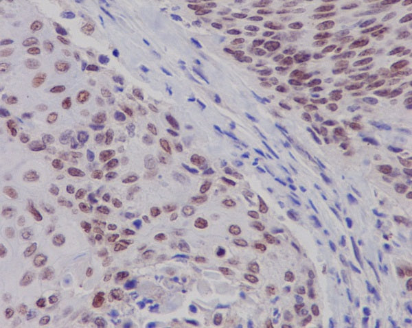 Anti-Estrogen Receptor beta Rabbit Polyclonal Antibody
