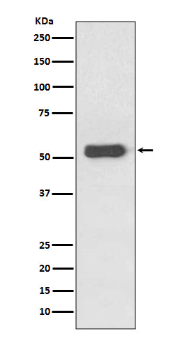 Anti-Estrogen Receptor beta Rabbit Polyclonal Antibody