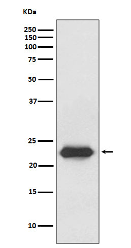 Anti-Lipocalin 2 Rabbit Polyclonal Antibody