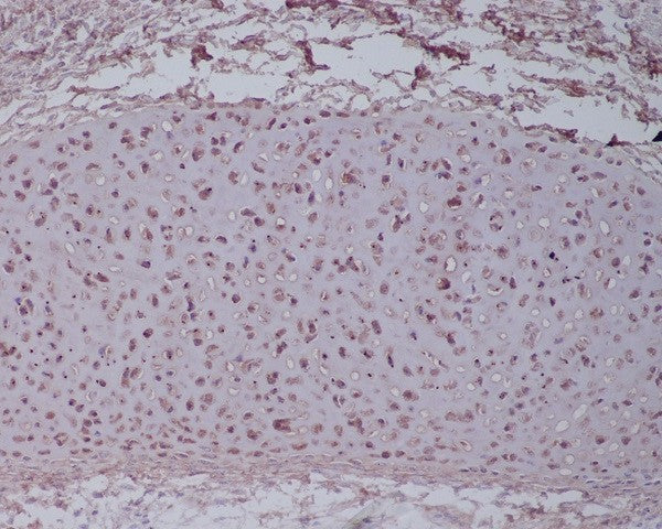 Anti-Aggrecan Rabbit Polyclonal Antibody