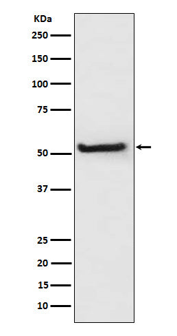 Anti-Thioredoxin Interacting Protein Rabbit Polyclonal Antibody