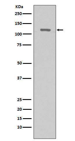 Anti-Telomerase Reverse Transcriptase Rabbit Polyclonal Antibody