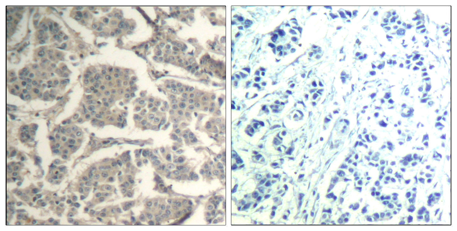Anti-Cofilin Rabbit Polyclonal Antibody