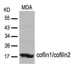 Anti-Cofilin Rabbit Polyclonal Antibody
