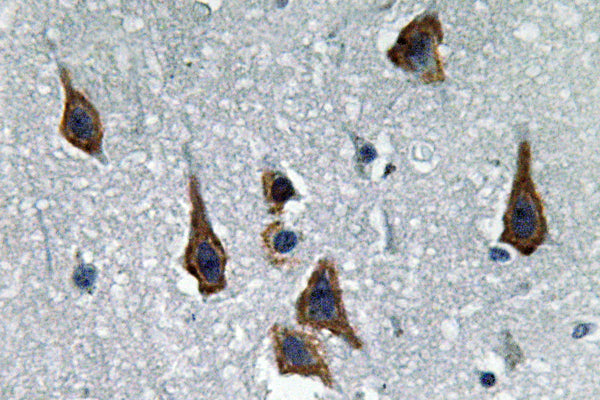 Anti-ABCG2 Rabbit Polyclonal Antibody