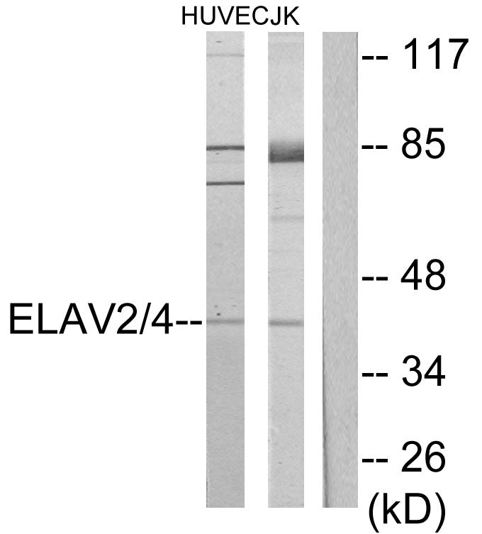 Anti-HuB/HuD Rabbit Polyclonal Antibody