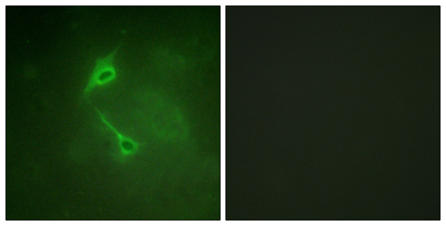 Anti-PKC zeta Rabbit Polyclonal Antibody