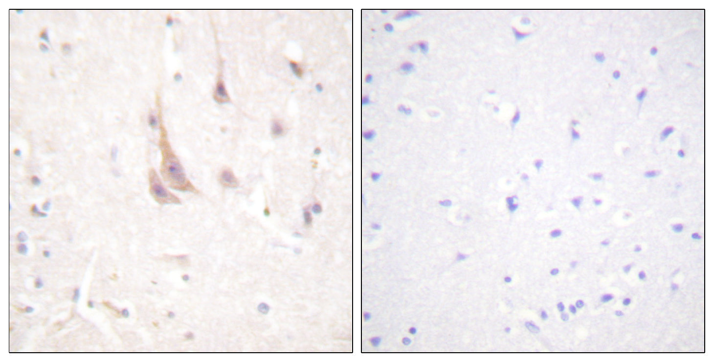Anti-PKC zeta Rabbit Polyclonal Antibody