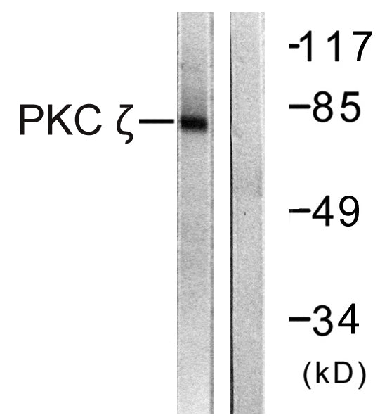 Anti-PKC zeta Rabbit Polyclonal Antibody
