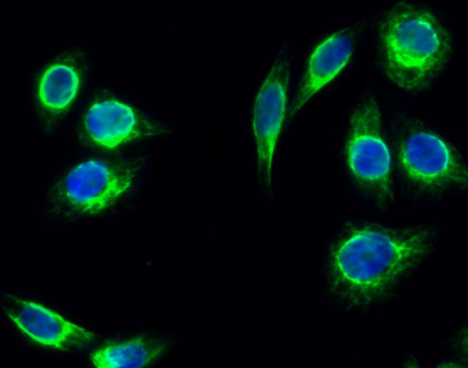 Anti-TSG101 Rabbit Polyclonal Antibody