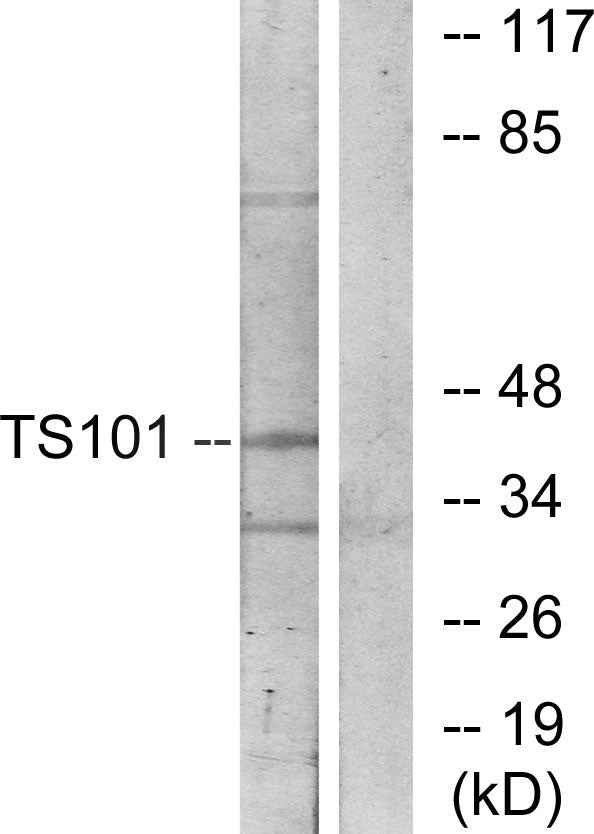 Anti-TSG101 Rabbit Polyclonal Antibody