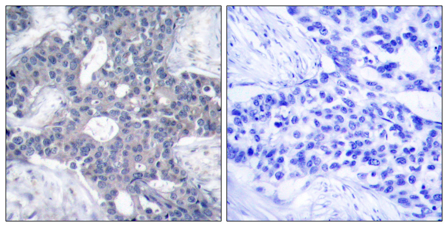 Anti-ZAP70 Rabbit Polyclonal Antibody