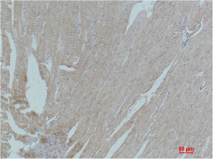 Anti-PPAR gamma Rabbit Polyclonal Antibody