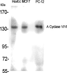 Anti-ADCY5/6 Rabbit Polyclonal Antibody