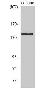 Anti-ADCY5/6 Rabbit Polyclonal Antibody