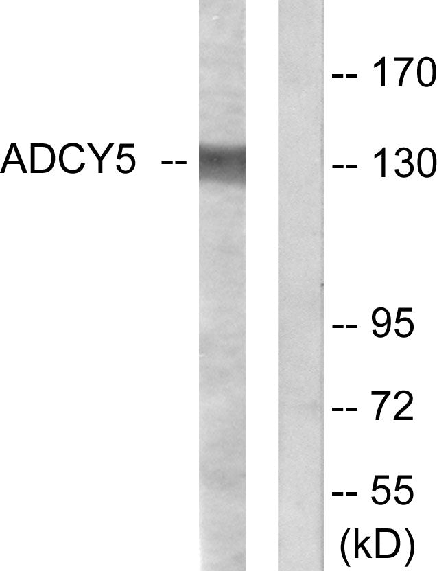 Anti-ADCY5/6 Rabbit Polyclonal Antibody