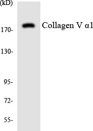 Anti-ADCY5/6 Rabbit Polyclonal Antibody