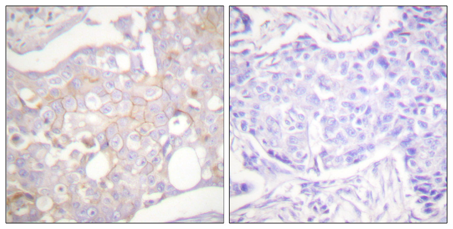 Anti-Claudin 4 Rabbit Polyclonal Antibody