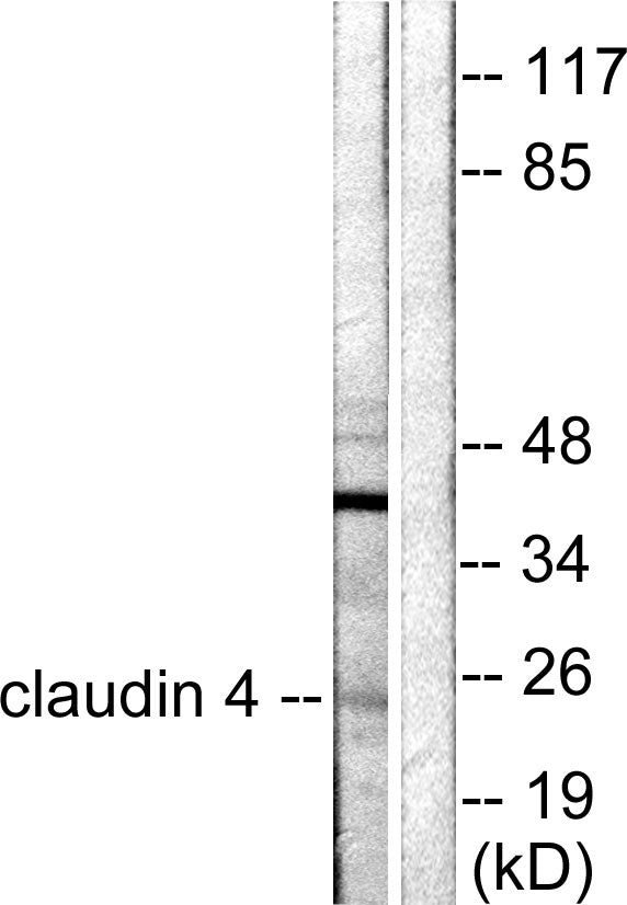 Anti-Claudin 4 Rabbit Polyclonal Antibody