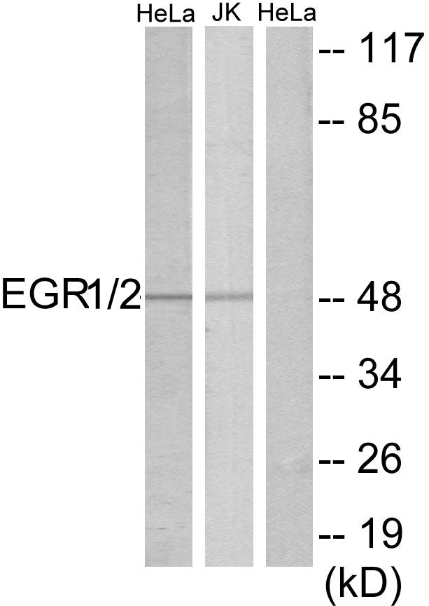 Anti-EGR2 Rabbit Polyclonal Antibody