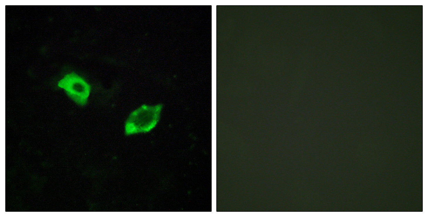 Anti-GPR158 Rabbit Polyclonal Antibody