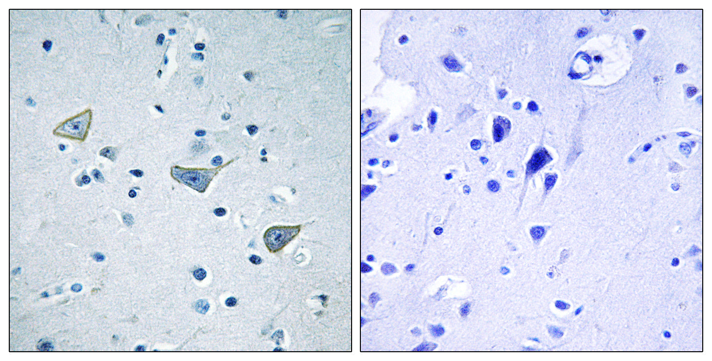 Anti-GPR158 Rabbit Polyclonal Antibody