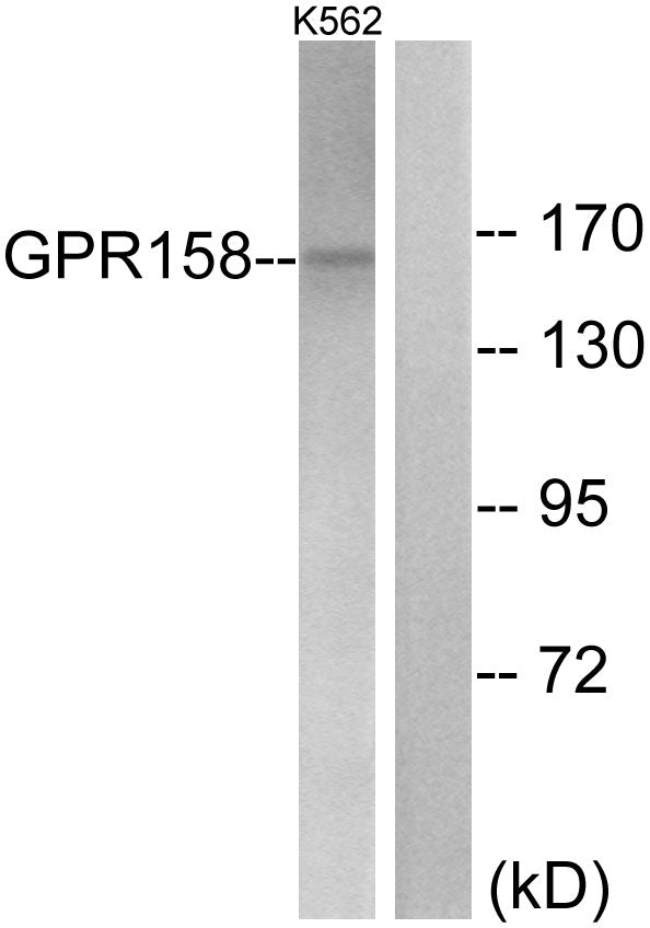 Anti-GPR158 Rabbit Polyclonal Antibody