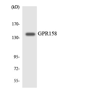 Anti-GPR158 Rabbit Polyclonal Antibody