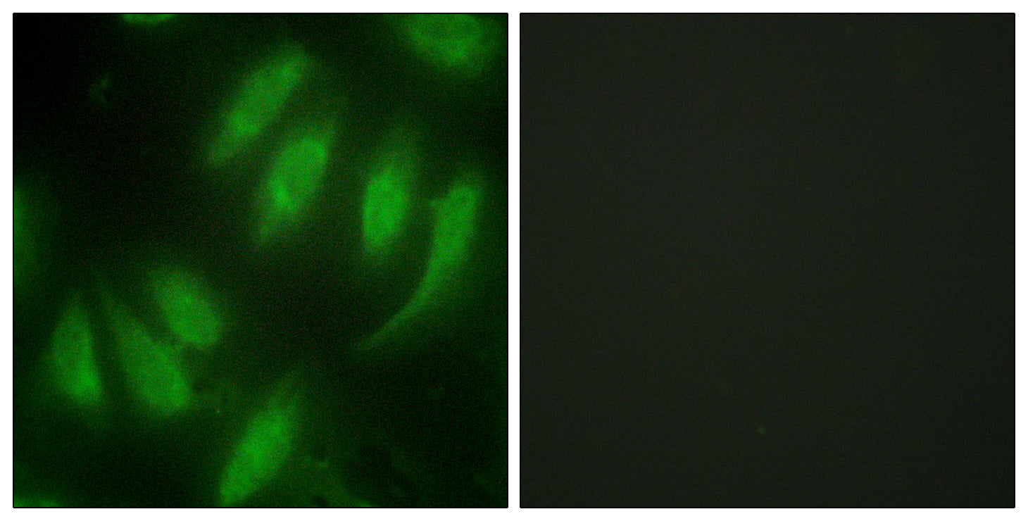 Anti-HEXIM1 Rabbit Polyclonal Antibody