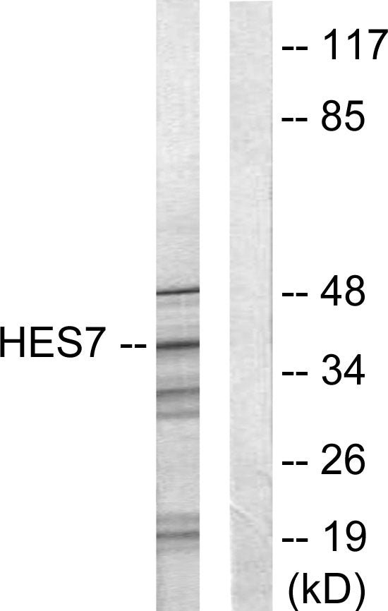 Anti-HEXIM1 Rabbit Polyclonal Antibody