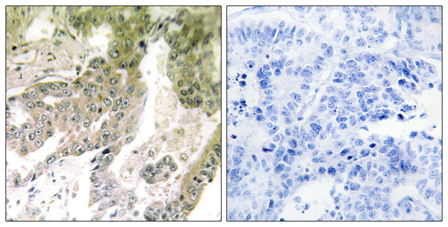 Anti-Laminin alpha 5 Rabbit Polyclonal Antibody