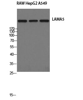 Anti-Laminin alpha 5 Rabbit Polyclonal Antibody