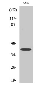 Anti-TACSTD2 Rabbit Polyclonal Antibody