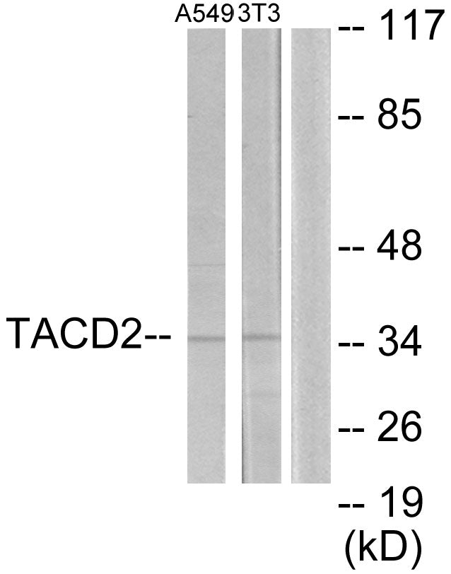 Anti-TACSTD2 Rabbit Polyclonal Antibody
