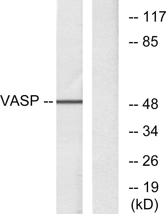 Anti-VASP Rabbit Polyclonal Antibody