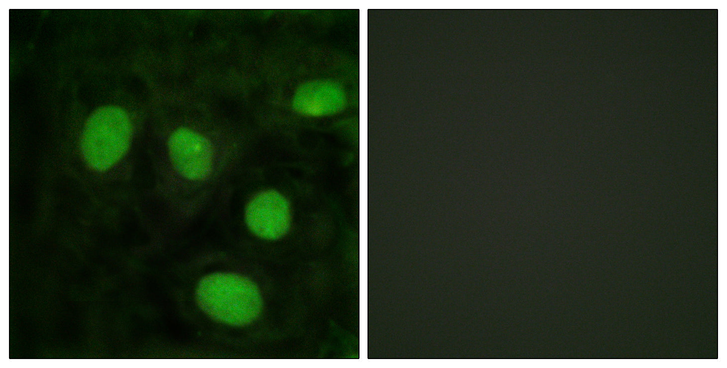 Anti-Histone H1.8 Rabbit Polyclonal Antibody