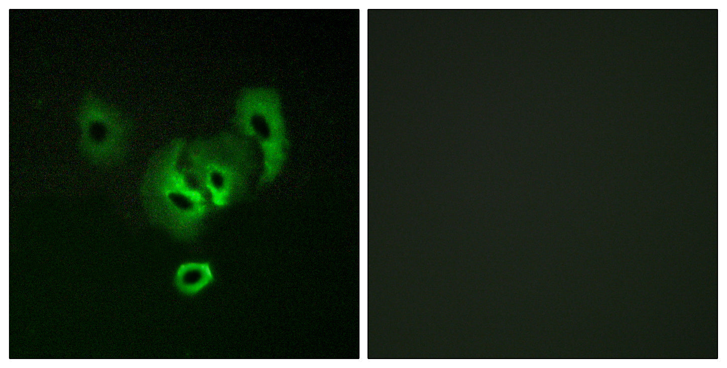 Anti-STEAP2 Rabbit Polyclonal Antibody