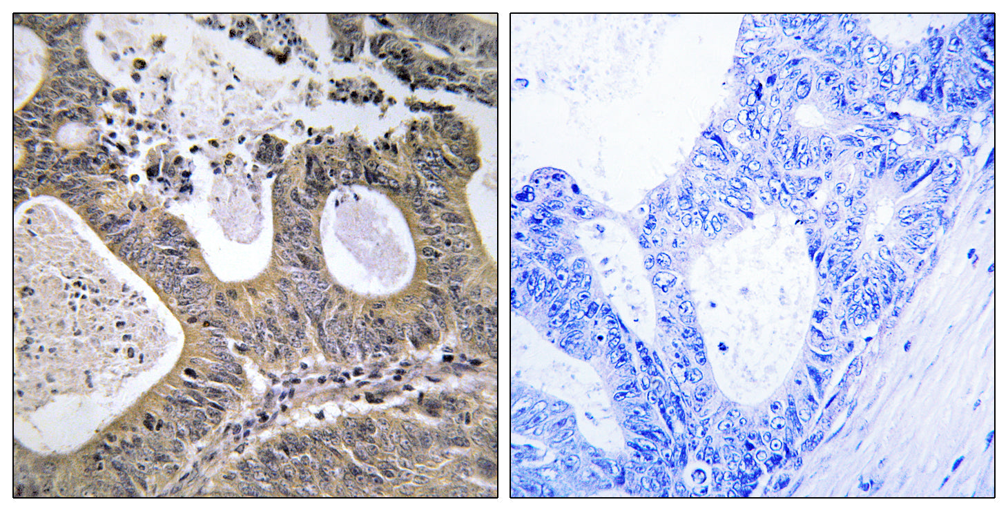 Anti-STEAP2 Rabbit Polyclonal Antibody