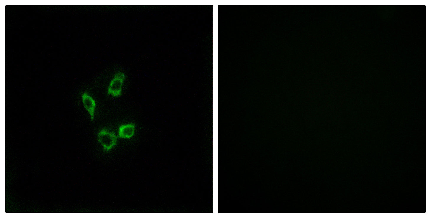 Anti-Cytochrome P450 4Z1 Rabbit Polyclonal Antibody