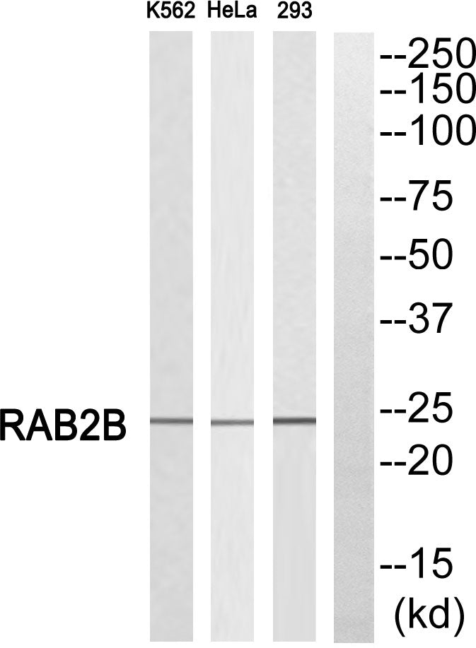 Anti-Rab2B Rabbit Polyclonal Antibody