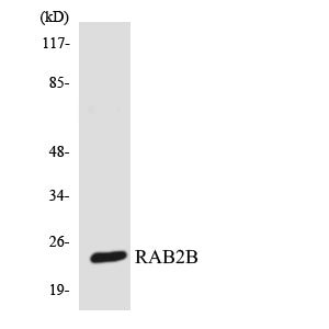 Anti-Rab2B Rabbit Polyclonal Antibody