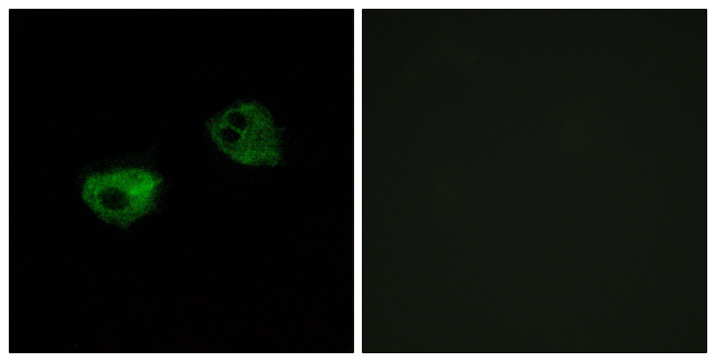 Anti-Melatonin Receptor 1A Rabbit Polyclonal Antibody