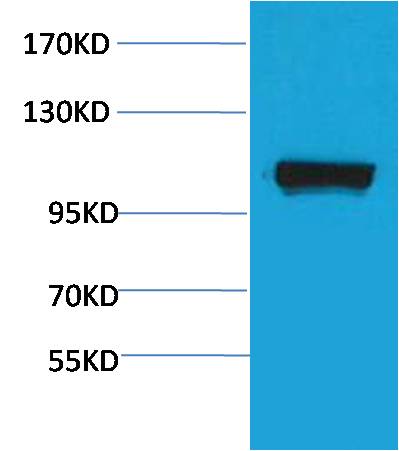 Anti-PEPC Rabbit Polyclonal Antibody
